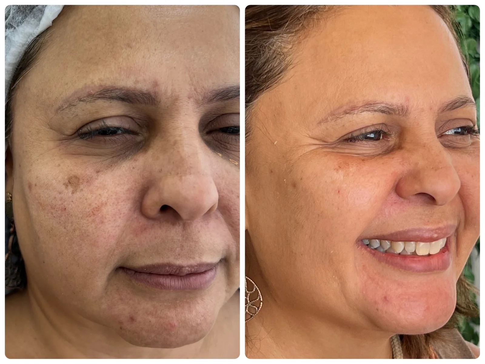 Antes e depois de quem seguiu o passo a passo